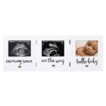 Triple Sonogram Keepsake Picture Frame White Hinged Display Ultrasound Pregnancy Journey Ideal Gift Expecting Parents 3 - Image 5