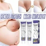 Stretch Marks Remove Cream Firm Lift Skin Cream Improves Elasticity Effective Remove Marks After Pregnancy Maternity Fades Marks