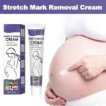 Stretch Marks Remove Cream Firm Lift Skin Cream Improves Elasticity Effective Remove Marks After Pregnancy Maternity Fades Marks - Image 3