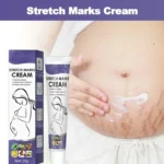 Stretch Marks Remove Cream Firm Lift Skin Cream Improves Elasticity Effective Remove Marks After Pregnancy Maternity Fades Marks - Image 5