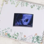A4 Pregnancy Journey Memory Books Perfect Planner Photo Collection Pregnancy Examination Records Diary Keepsake Books - Image 2